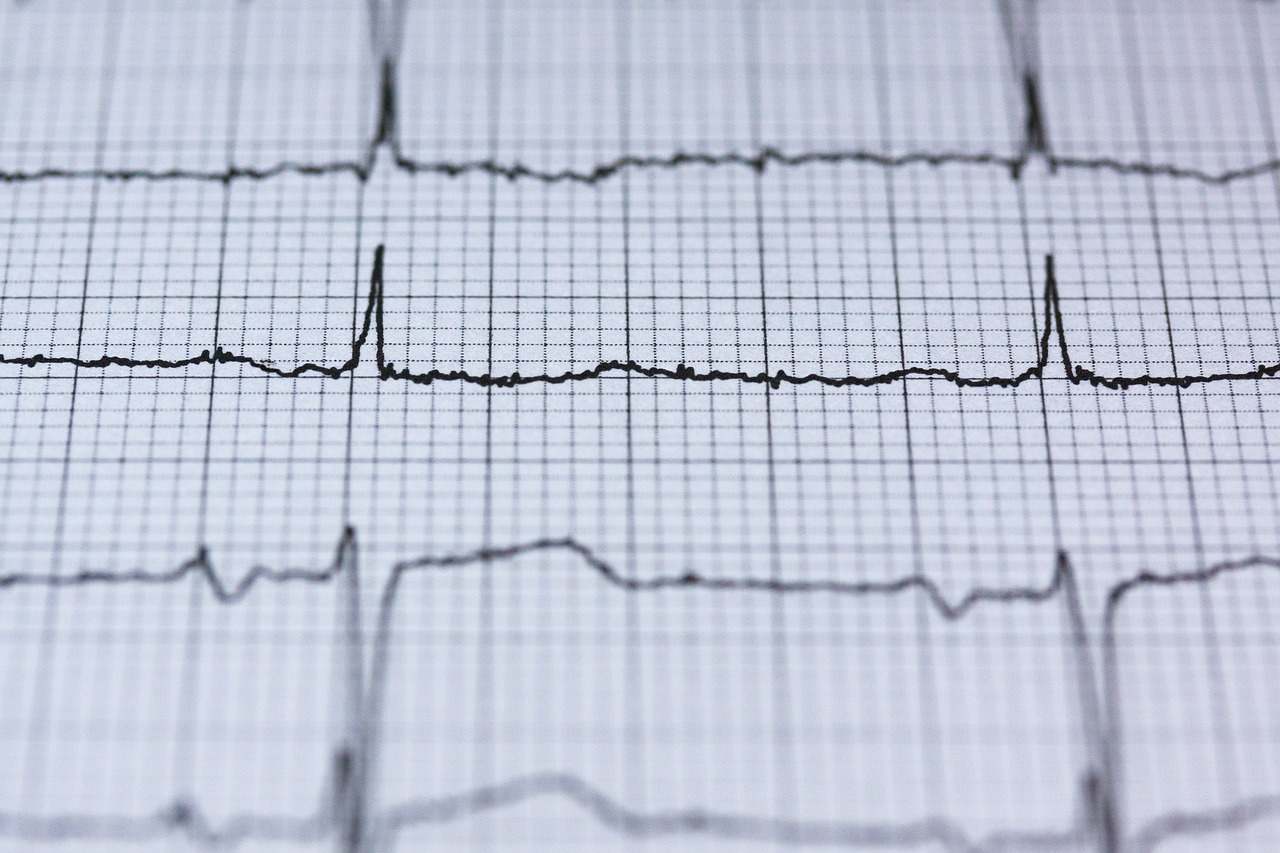 What is your Heartbeat?